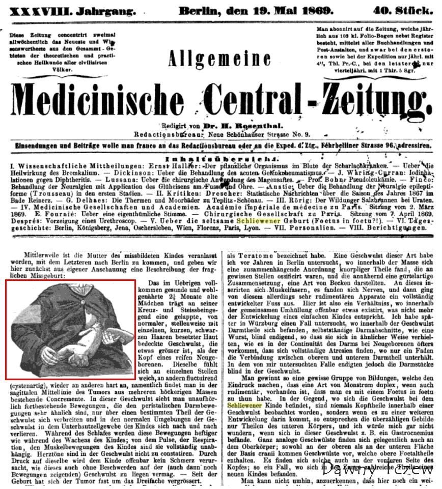 Schliewener Kind Rycina.JPG